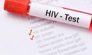 Test HIV z zaznaczonymi pozycjami "HIV antibody" i "HIV antigen". Wczesne wykrycie aids objawy jest kluczowe.