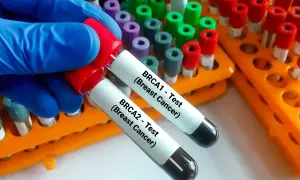 Rękawiczka w niebieskiej rękawiczce trzyma probówki do badań genetycznych na raka: BRCA1 i BRCA2.