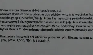 Wynik biopsji: gruczolakorak stercza Gleason 7(4+3). Czy biopsja oznacza raka? Tak, w tym przypadku potwierdzono obecność nowotworu.