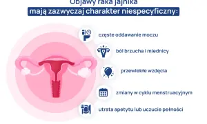 Grafika przedstawia narządy rodne kobiety i ikonki symbolizujące objawy raka jajnika: częste oddawanie moczu, ból brzucha, wzdęcia, zmiany cyklu, utratę apetytu.