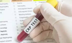 Ręka w rękawiczce trzyma probówkę z krwią do badania CRP. Wynik badania CRP norma jest kluczowy w diagnostyce stanu zapalnego.