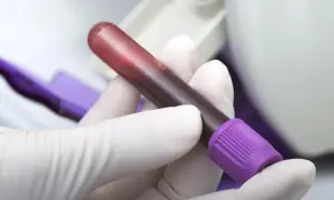 Ręka w białej rękawiczce trzyma probówkę z krwią. Badanie fibrynogen w ciąży jest kluczowe dla zdrowia matki i dziecka.