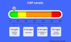 Wykres poziomu CRP: <10 mg/dL to zdrowy zakres, 10-20 mg/dL to podwyższony, 20-50 mg/dL to niebezpieczne poziomy, a 50+ mg/dL to poważne podwyższenie.