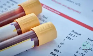 Probówki z krwią do psa badanie leżą obok wyników analizy biochemicznej.
