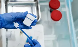 Rękawiczki medyczne trzymają pojemnik i szczoteczkę do pobierania wymazu. Przygotowanie do cytologii płynnej.