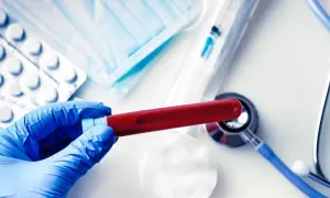 Rękawiczka w niebieskiej rękawiczce trzyma probówkę z krwią. Obok leżą maseczka, tabletki, strzykawka i stetoskop. Wyniki badań, np. podwyższone AST, wymagają analizy.
