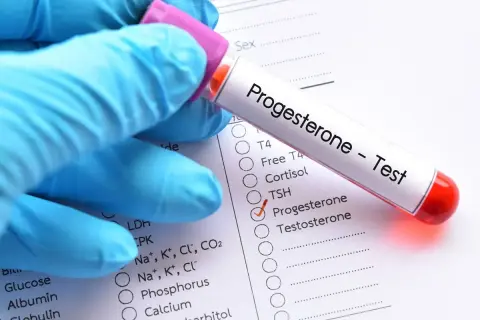 Rękawiczka w niebieskiej rękawiczce trzyma probówkę z napisem "Progesteron - Test". Obok zaznaczono pole "Progesteron".