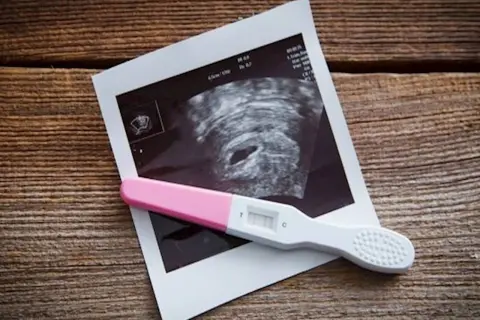 Test ciążowy i zdjęcie USG na drewnianym tle. Początek drogi przez trymestry ciąży.