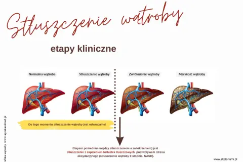 Grafika pokazuje etapy stłuszczenia wątroby: od normalnej, przez stłuszczenie (które jest odwracalne!), zwłóknienie, aż do marskości.