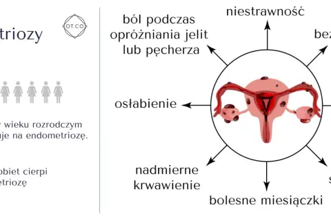 Objawy endometriozy: ból, bezpłodność, mdłości, osłabienie, niestrawność, nadmierne krwawienie, bolesne miesiączki i stosunki. 1 na 10 kobiet choruje.