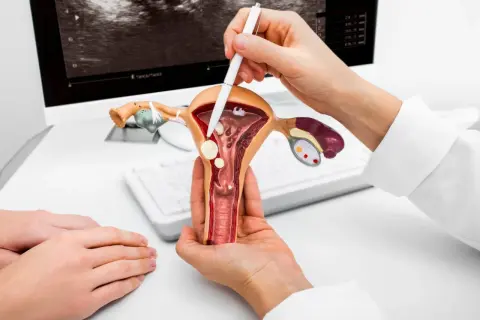 Lekarz pokazuje model narządów rodnych, omawiając, po jakim czasie nadżerka zmienia się w raka.