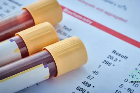 Probówki z krwią do psa badanie leżą obok wyników analizy biochemicznej.