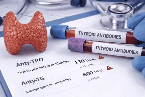Model tarczycy, probówki z "THYROID ANTIBODIES" i wyniki badań, w tym Anty-TPO.