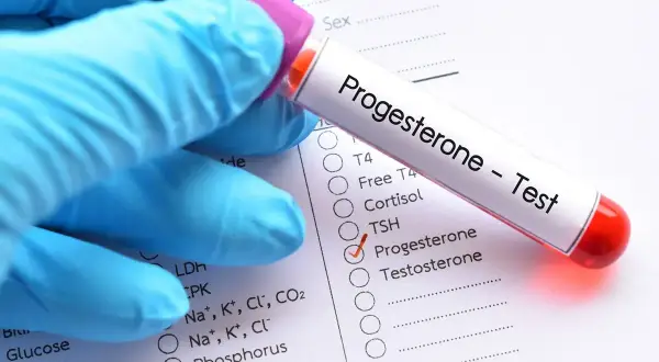 Rękawiczka w niebieskiej rękawiczce trzyma probówkę z napisem "Progesteron - Test". Obok zaznaczono pole "Progesteron".