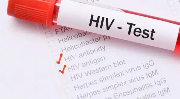 Test HIV z zaznaczonymi pozycjami "HIV antibody" i "HIV antigen". Wczesne wykrycie aids objawy jest kluczowe.