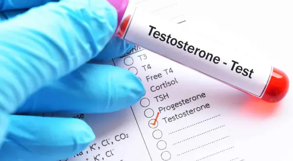 Rękawiczka w niebieskiej rękawiczce trzyma probówkę z krwią do testu na **za co odpowiada testosteron**. Zaznaczono go na liście badań.