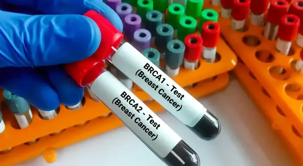 Rękawiczka w niebieskiej rękawiczce trzyma probówki do badań genetycznych na raka: BRCA1 i BRCA2.