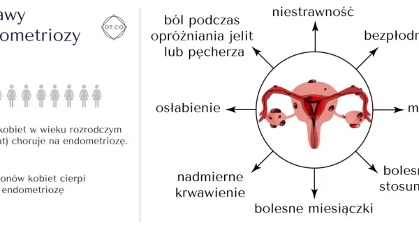Objawy endometriozy: ból, bezpłodność, mdłości, osłabienie, niestrawność, nadmierne krwawienie, bolesne miesiączki i stosunki. 1 na 10 kobiet choruje.