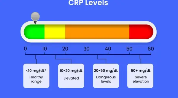 Wykres poziomu CRP: <10 mg/dL to zdrowy zakres, 10-20 mg/dL to podwyższony, 20-50 mg/dL to niebezpieczne poziomy, a 50+ mg/dL to poważne podwyższenie.
