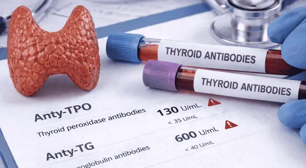 Model tarczycy, probówki z "THYROID ANTIBODIES" i wyniki badań, w tym Anty-TPO.