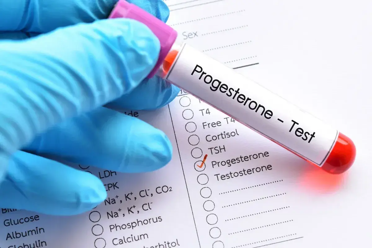Rękawiczka w niebieskiej rękawiczce trzyma probówkę z napisem "Progesteron - Test". Obok zaznaczono pole "Progesteron".