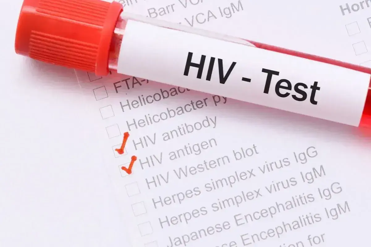 Test HIV z zaznaczonymi pozycjami "HIV antibody" i "HIV antigen". Wczesne wykrycie aids objawy jest kluczowe.