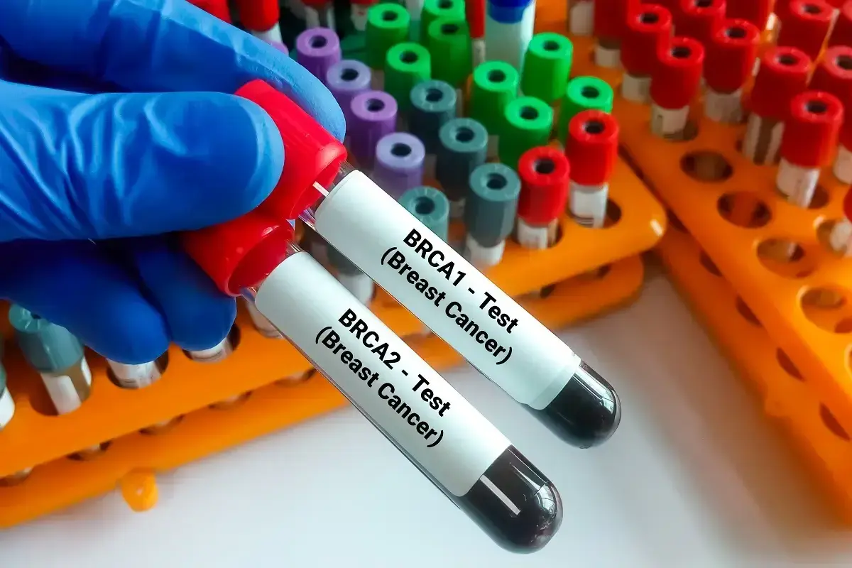 Rękawiczka w niebieskiej rękawiczce trzyma probówki do badań genetycznych na raka: BRCA1 i BRCA2.
