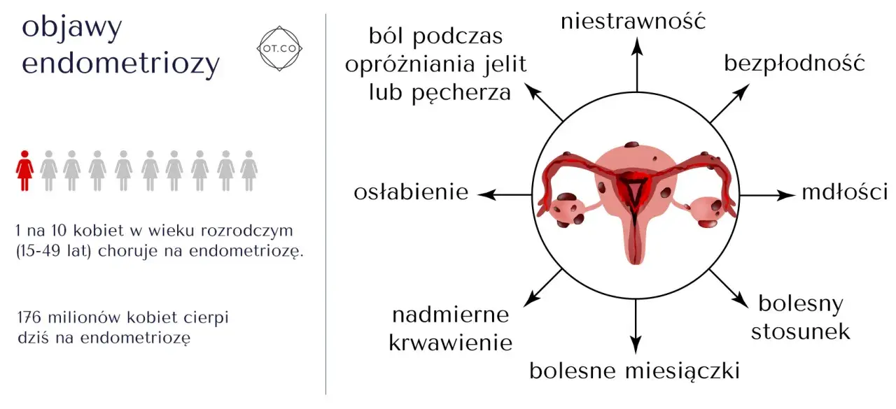 Objawy endometriozy: ból, bezpłodność, mdłości, osłabienie, niestrawność, nadmierne krwawienie, bolesne miesiączki i stosunki. 1 na 10 kobiet choruje.