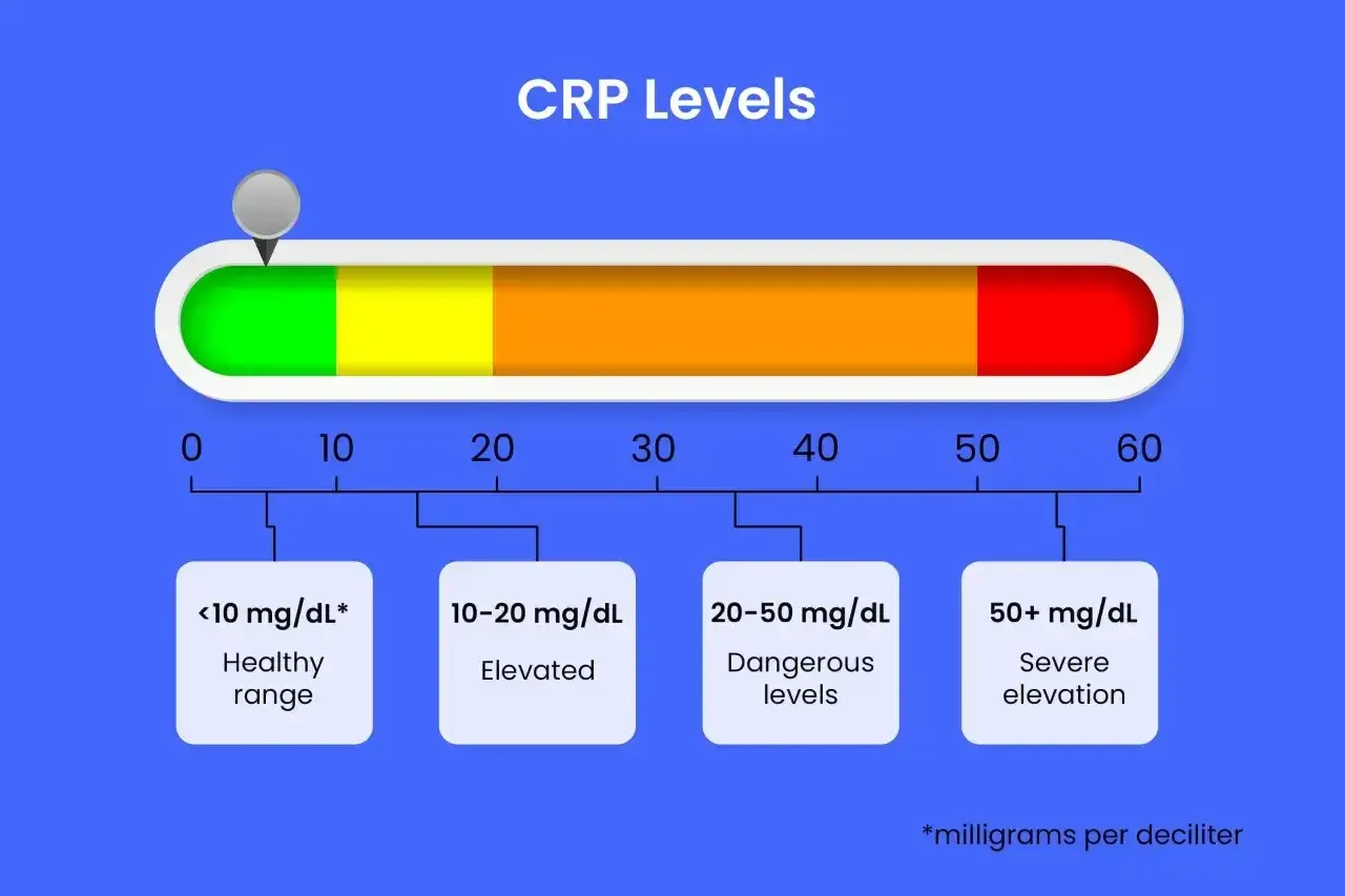 Wykres poziomu CRP: <10 mg/dL to zdrowy zakres, 10-20 mg/dL to podwyższony, 20-50 mg/dL to niebezpieczne poziomy, a 50+ mg/dL to poważne podwyższenie.