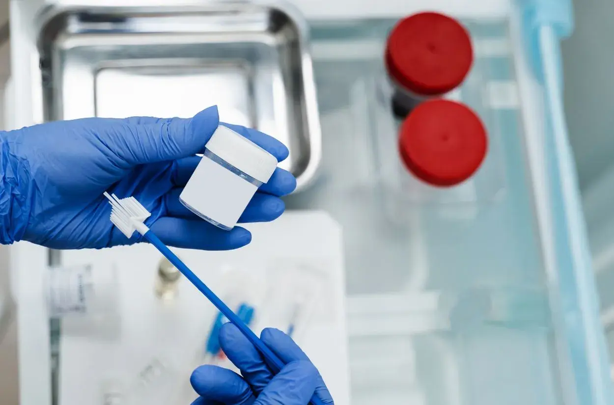 Rękawiczki medyczne trzymają pojemnik i szczoteczkę do pobierania wymazu. Przygotowanie do cytologii płynnej.