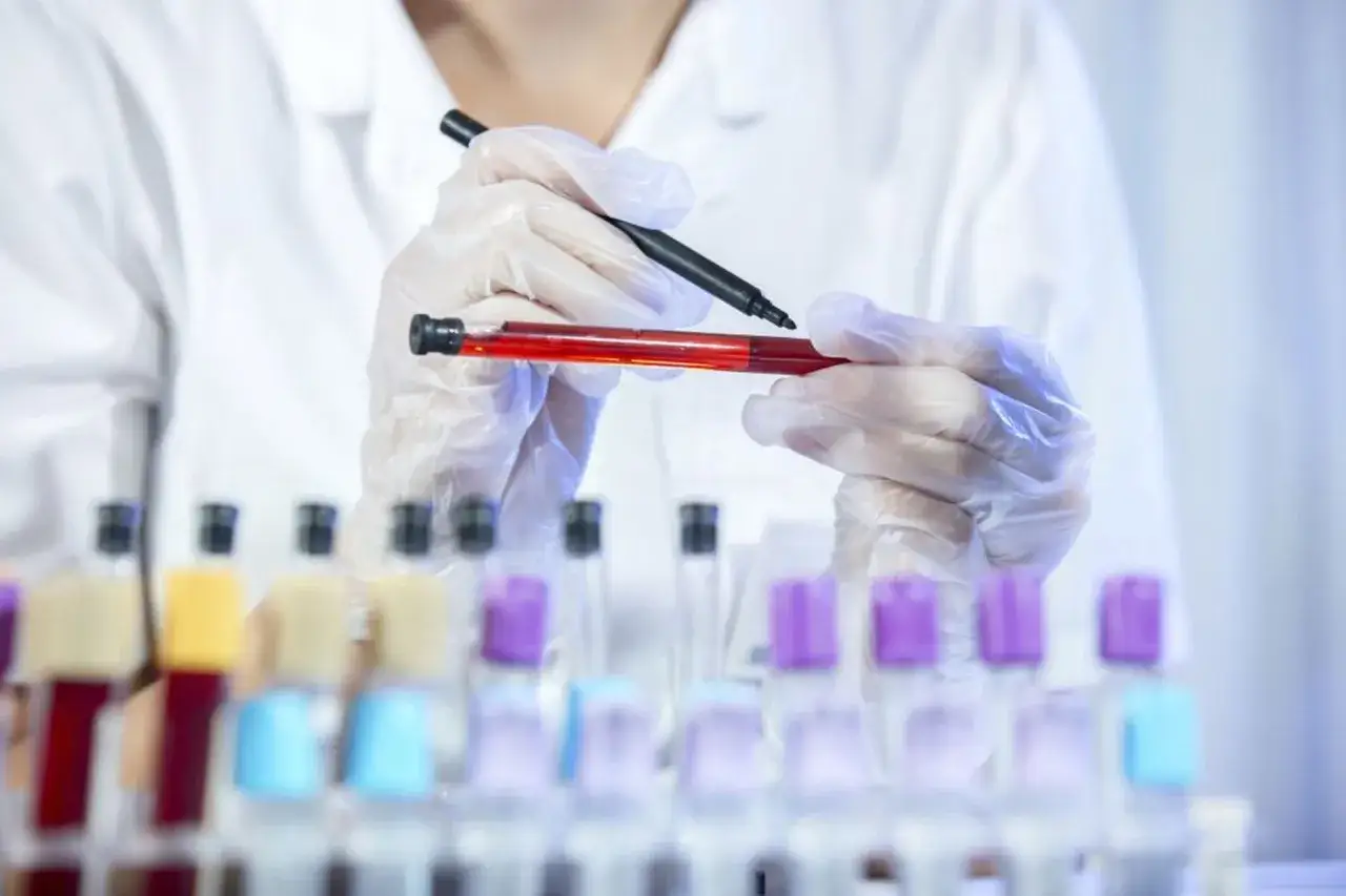 Laborantka w rękawiczkach bada pr&oacute;bkę krwi, analizując potencjalne przyczyny neutropenii. Co to jest neutropenia?
