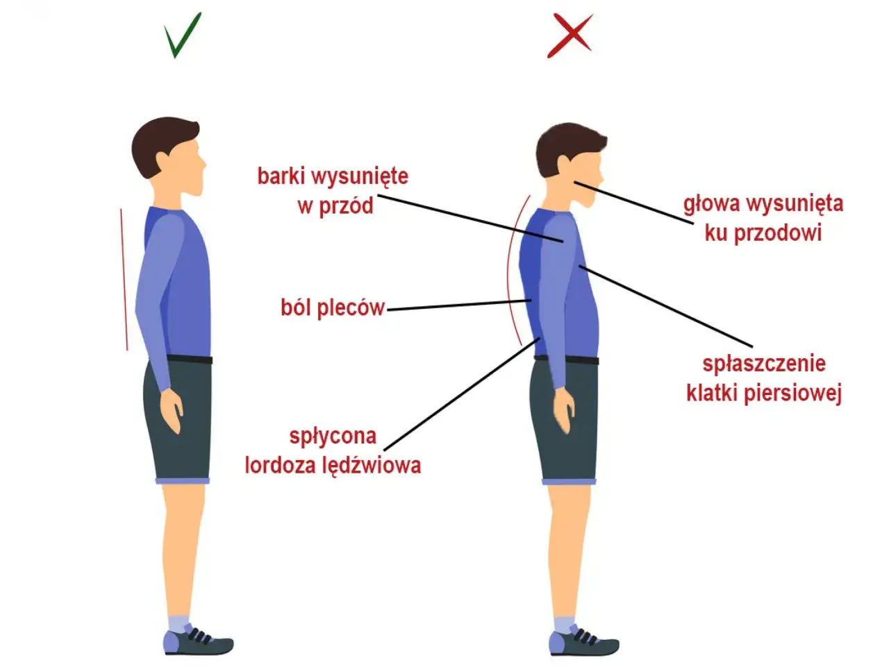 Złe ZZSK to przygarbiona postawa, wysunięta głowa i barki, b&oacute;l plec&oacute;w, spłaszczona klatka piersiowa. Prawidłowa postawa jest prosta.