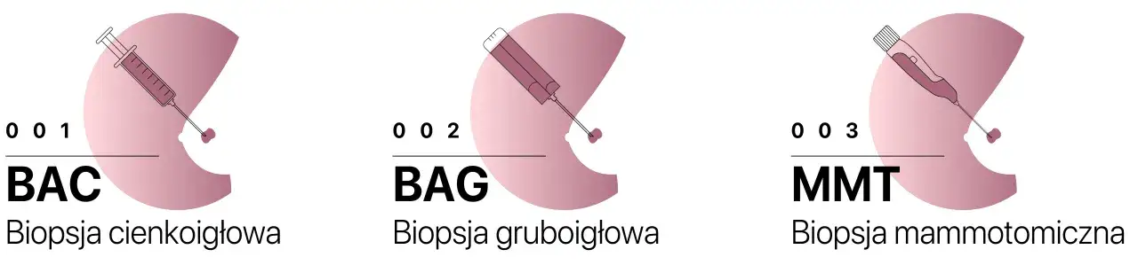 Trzy rodzaje biopsji: cienkoigłowa (BAC), gruboigłowa (BAG) i mammotomiczna (MMT). Czas trwania biopsji zależy od metody.