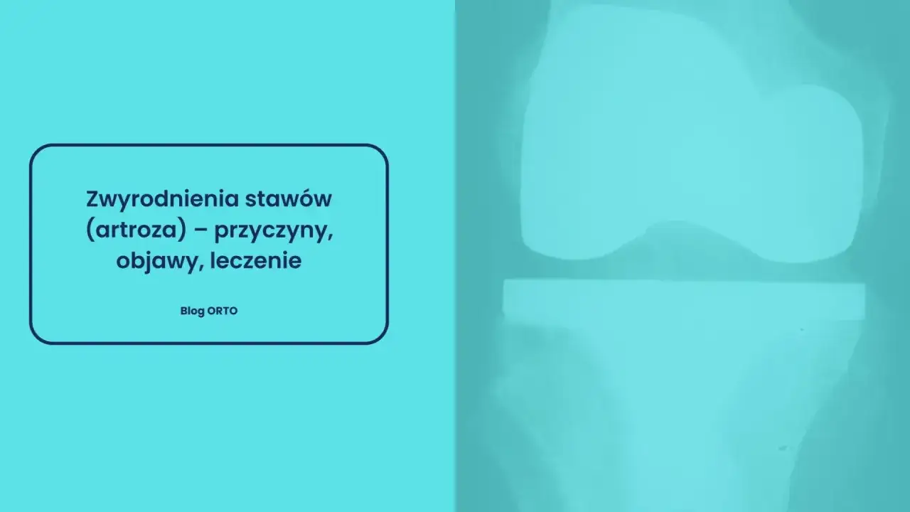 Artroza co to? Zwyrodnienia staw&oacute;w, ich przyczyny, objawy i leczenie. Rentgen kolana.